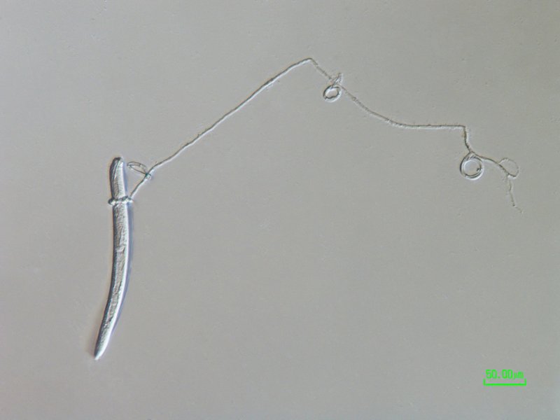 nematode trapping fungus.jpg